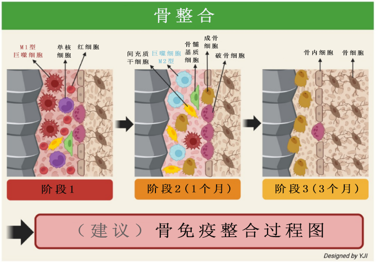 钛合金：医疗领域的“万能金属”是如何炼成的？(图2)