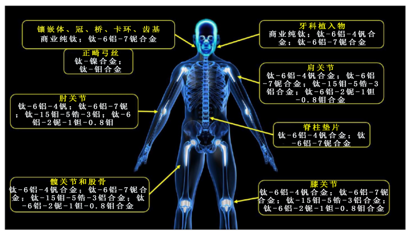 钛合金：医疗领域的“万能金属”是如何炼成的？(图3)
